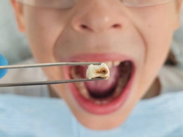 Best Holiday Emergency Dentist in West Sharyland, TX